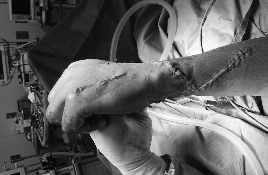 Cam Kesiği: Elde Gizli Tendon ve Sinir Yaralanmaları